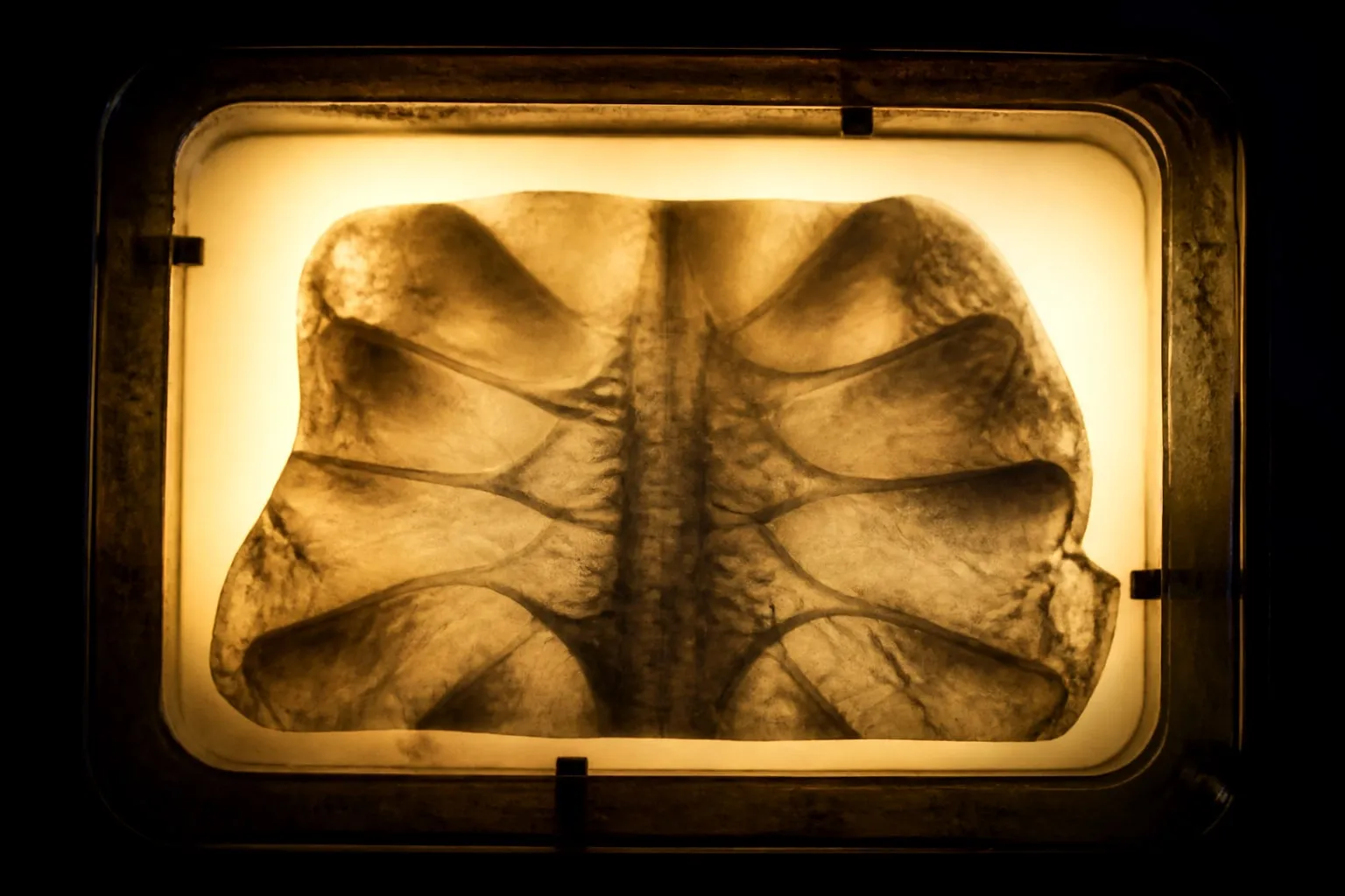 Editorial illustration: dental x ray film light box close up